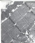 mitocndria